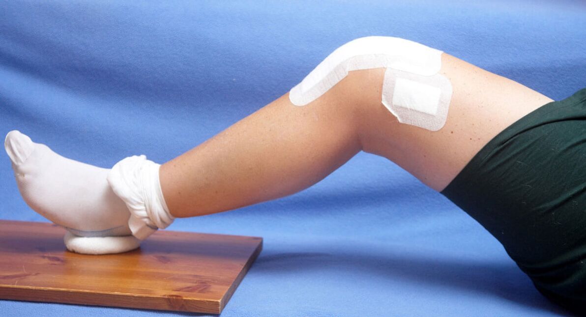 Lesión de rodilla como causa de artrosis