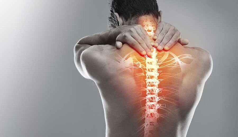 Osteocondrosis del cuello