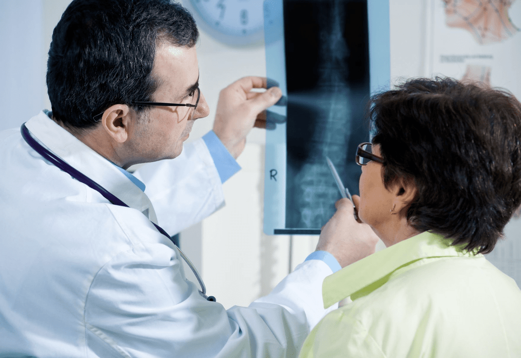 Un neurólogo diagnostica osteocondrosis mediante una radiografía de la columna