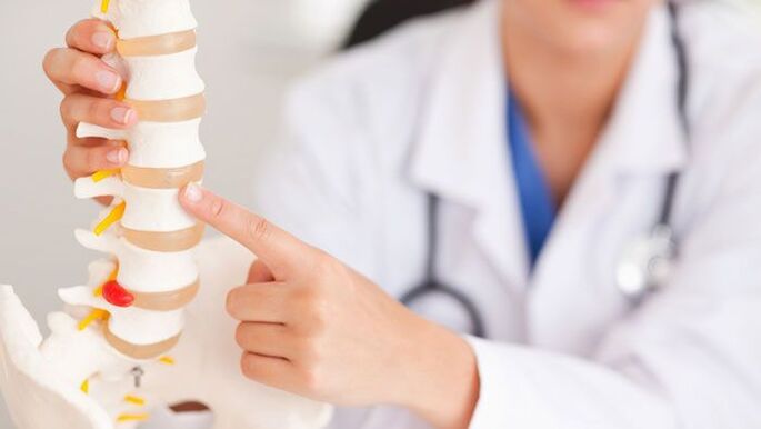 Explicación de la osteocondrosis lumbar mediante un modelo de columna